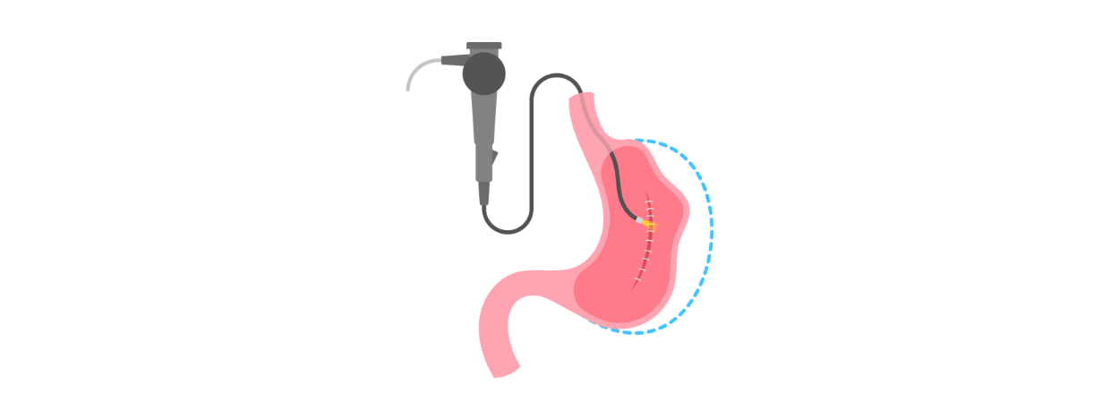 Endoscopic Spine Surgeon